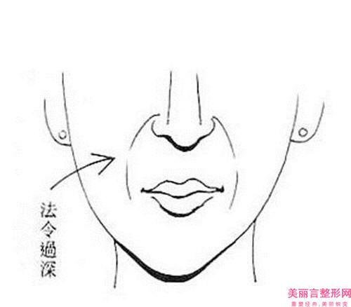 清除颈上细纹的价格详细介绍