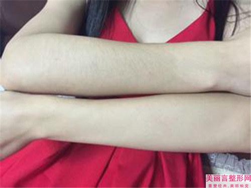 眉毛种植技术的价格基准是好多