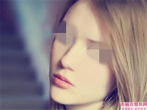 隆鼻手术的应用人群_什么人能采取隆鼻手术？