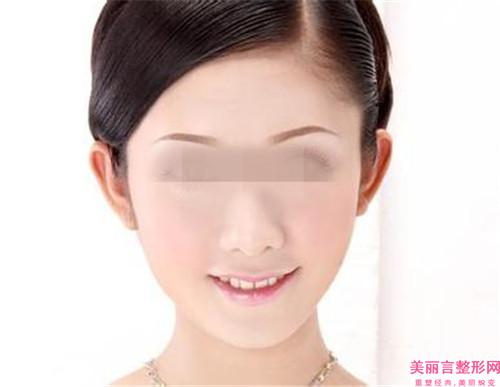 自体脂肪填充面部手术使用什么型材好？有不良反应吗？